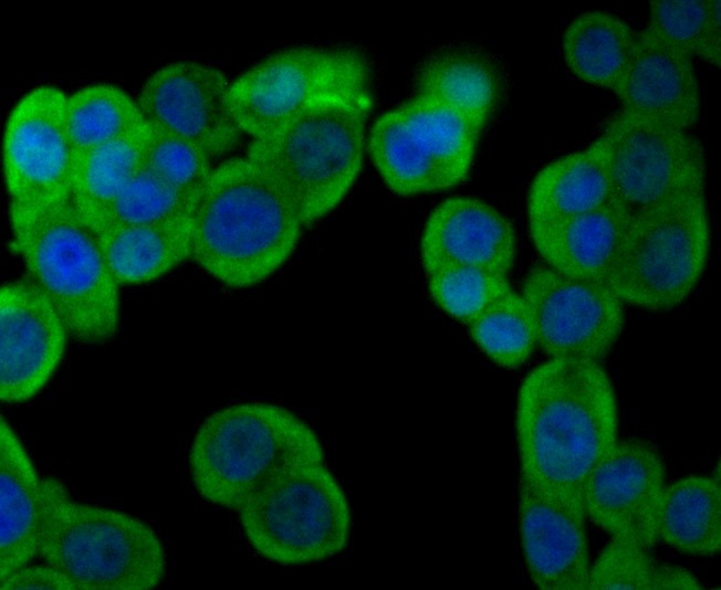 Anti-PFKM Antibody (4A746)