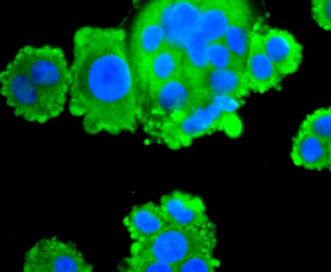 Anti-FASN Antibody (5Z147)