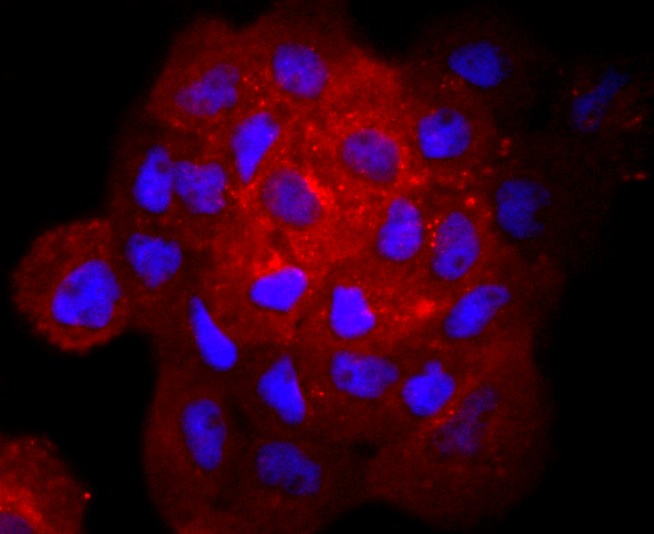 Anti-gamma Catenin Antibody (1O589)