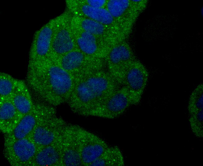 Anti-SNCG Antibody (8D869)