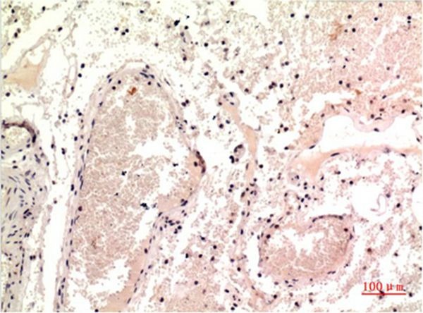 Anti-Gamma Tubulin Antibody (2M967)