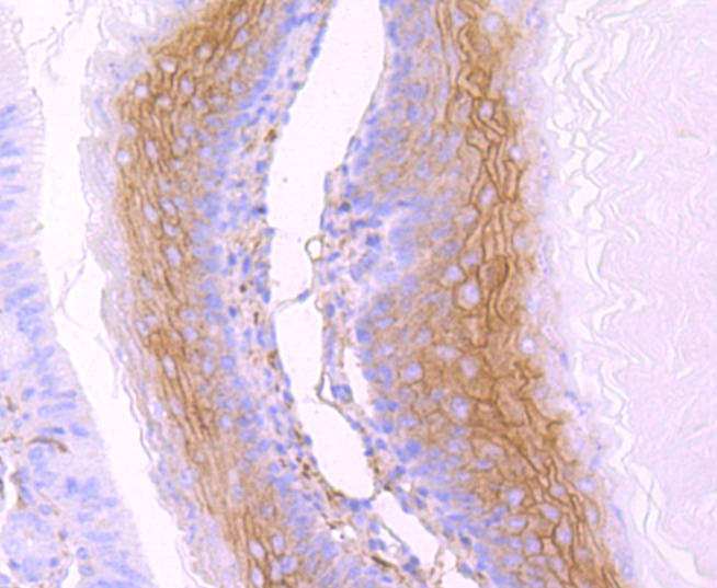 Anti-gamma Catenin Antibody (1O589)