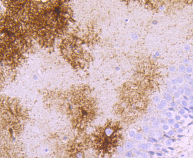 Anti-SNCG Antibody (8D869)