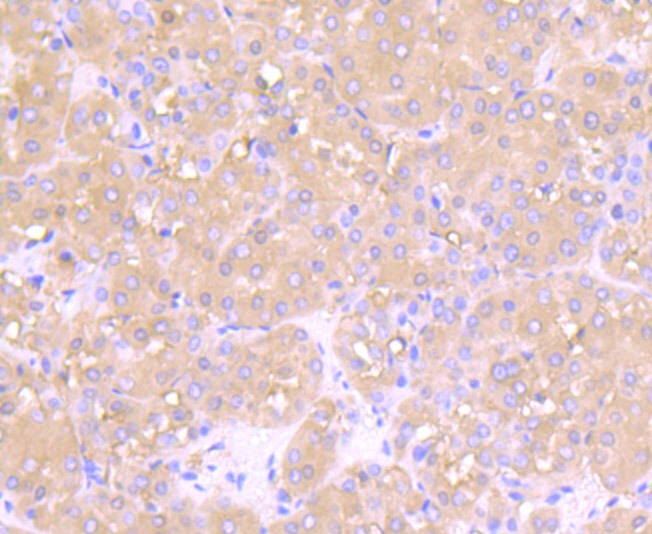 Anti-PFKM Antibody (4A746)