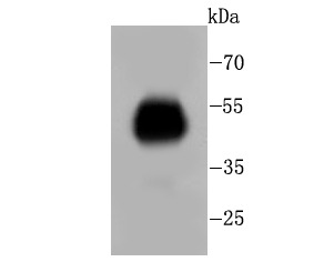 Anti-Fc epsilon RI Antibody (5H603)