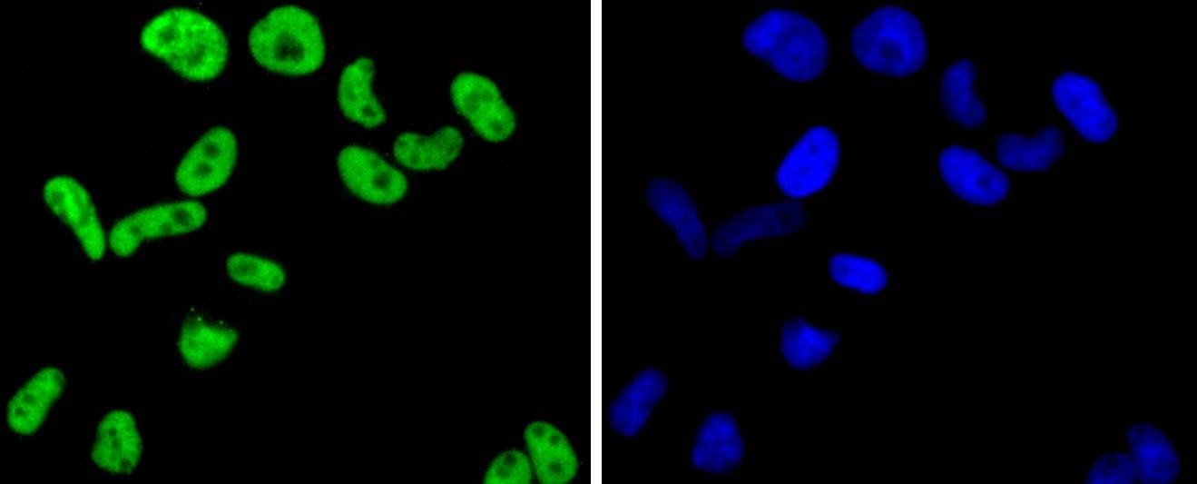 Anti-FUBP1 Antibody (1H129)