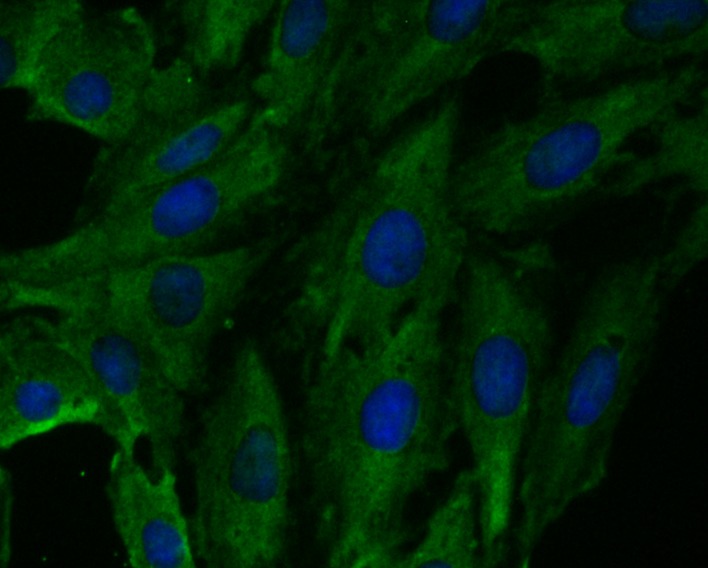 Anti-Fbx32 Antibody (6J554)