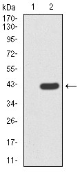 Anti-FBXL10 Antibody (6J798)