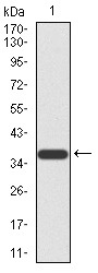 Anti-FBXL10 Antibody (6J798)