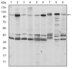 Anti-FUK Antibody (7P126)