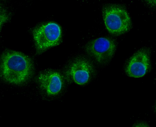 Anti-GCLM Antibody (9X353)