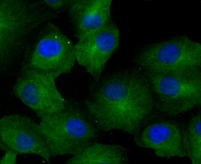 Anti-GCN2 Antibody (7U574)