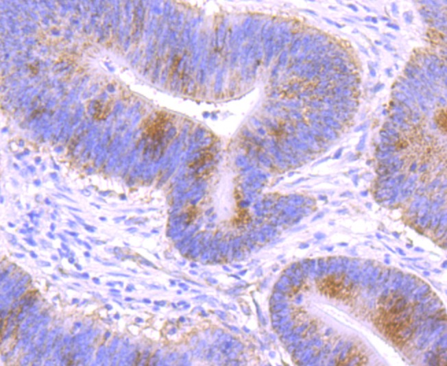 Anti-GCLM Antibody (9X353)