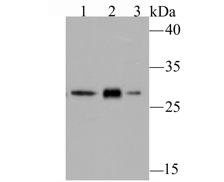 Anti-GCLM Antibody (9X353)
