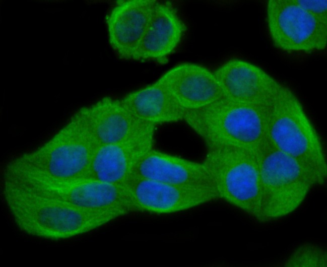 Anti-GCN2 Antibody (7U574)