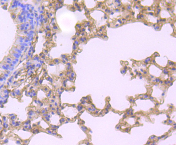 Anti-GSN Antibody (3E486)