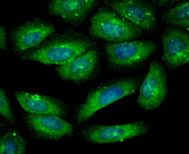 Anti-GSN Antibody (3E486)
