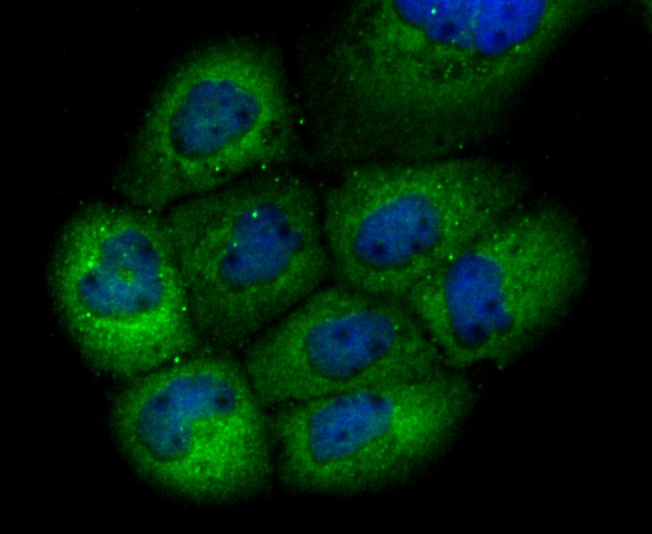 Anti-GCLM Antibody (9X353)