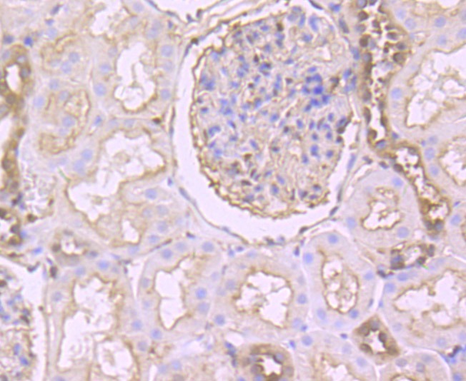 Anti-GSN Antibody (3E486)
