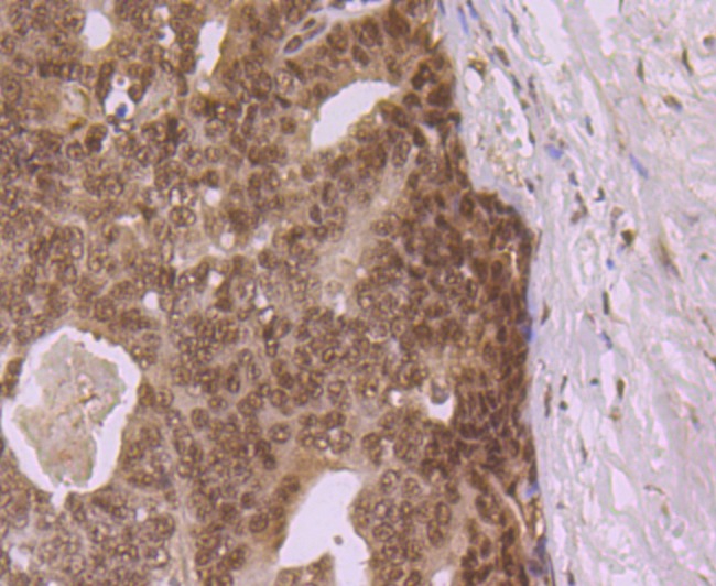 Anti-eIF4A3 Antibody (7D278)