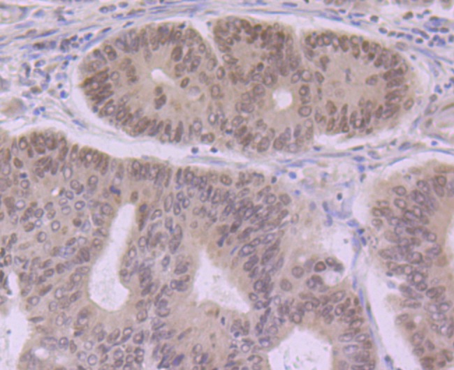 Anti-eIF4A3 Antibody (7D278)