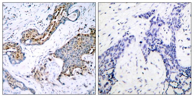 Anti-Phospho-ER alpha (Ser118) Polyclonal Antibody