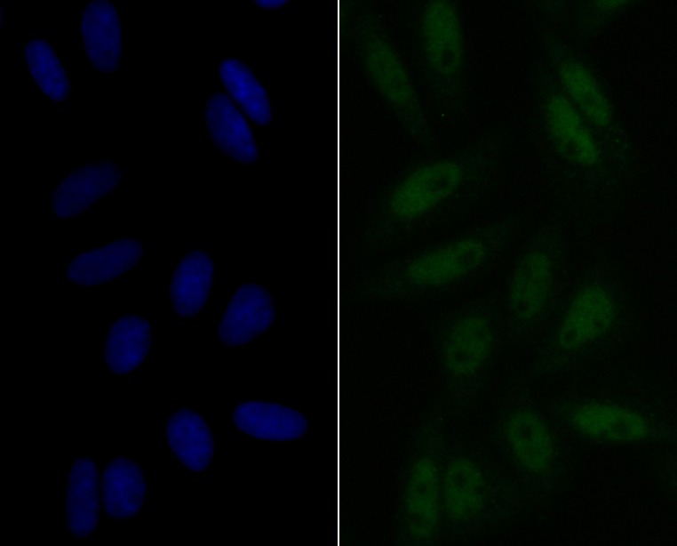 Anti-eIF4A3 Antibody (7D278)