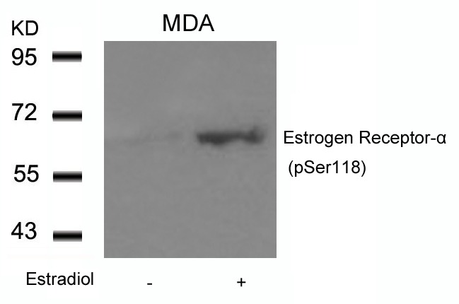 Anti-Phospho-ER alpha (Ser118) Polyclonal Antibody