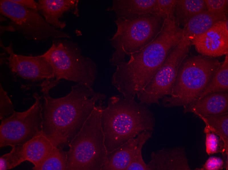 Anti-Phospho-ER alpha (Ser167) Polyclonal Antibody