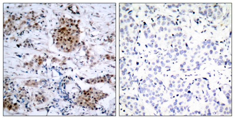 Anti-Phospho-ER alpha (Ser167) Polyclonal Antibody