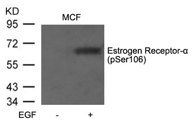 Anti-Phospho-ER alpha (Ser106) Polyclonal Antibody