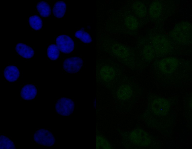 Anti-eIF4A3 Antibody (7D278)