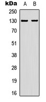 Anti-Phospho-EphA2 (Tyr588, 596) Polyclonal Antibody
