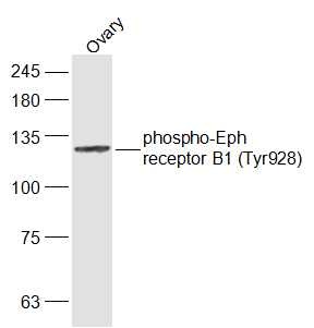 Anti-Phospho-EphB1 (Tyr928) Polyclonal Antibody