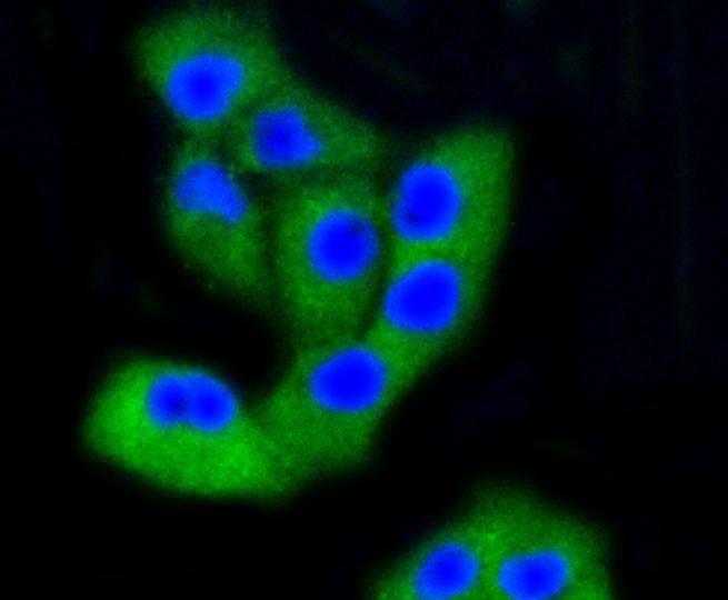 Anti-PTK2 Antibody (4L758)