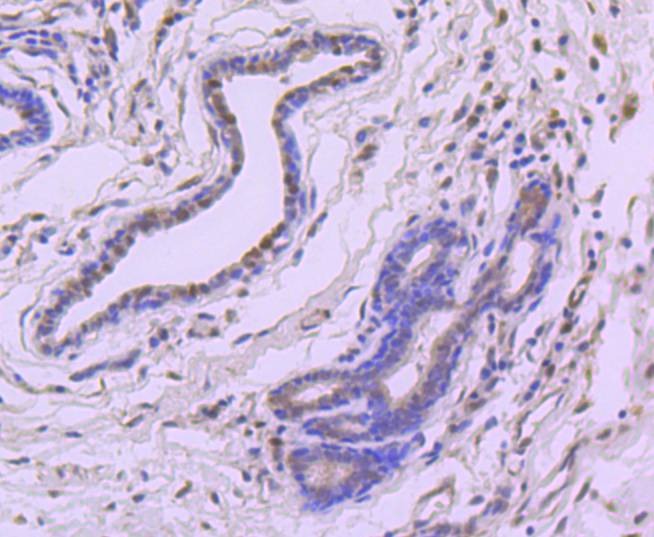 Anti-4EBP1 Antibody (5U577)