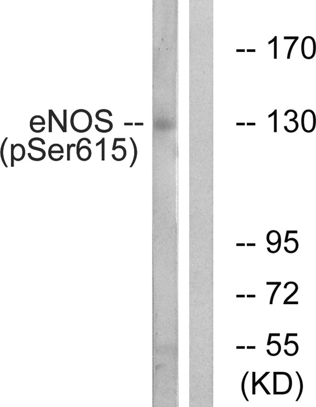 Anti-Phospho-eNOS (Ser615) Polyclonal Antibody