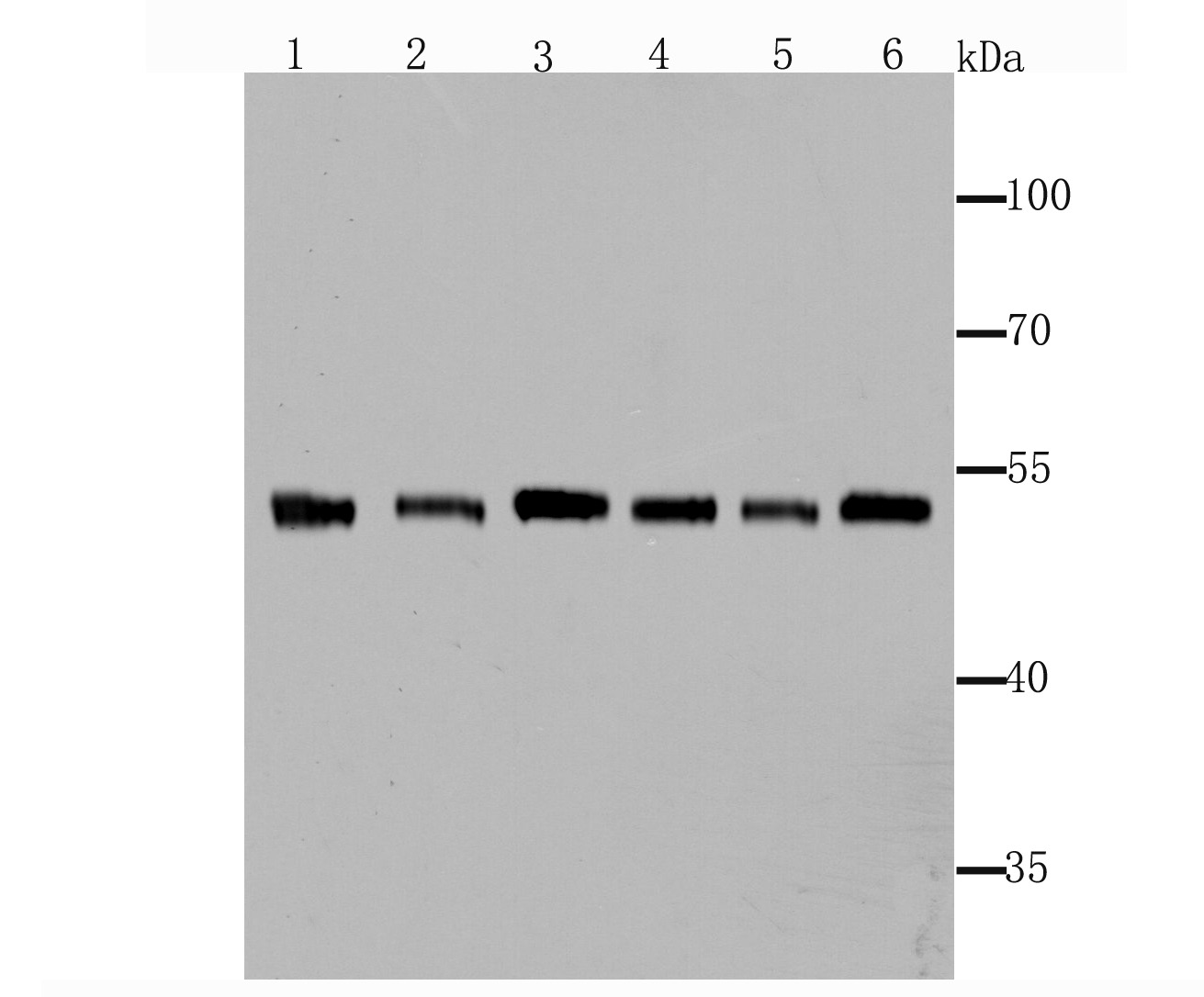 Anti-FSCN1 Antibody (7Z181)