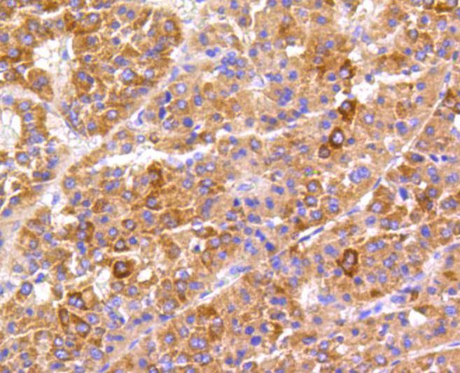 Anti-PTK2 Antibody (4L758)