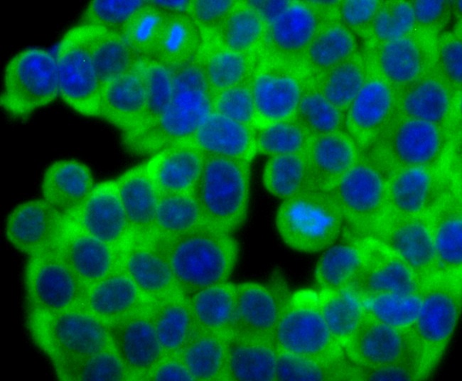 Anti-FSCN1 Antibody (7Z181)