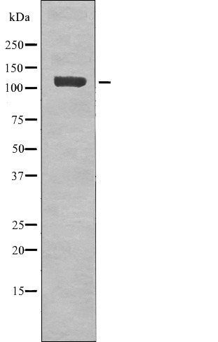 Anti-Phospho-EphB1/2 (Tyr778/780) Polyclonal Antibody