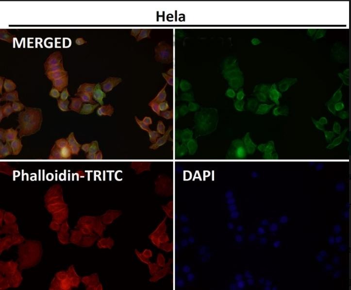 Anti-Ephrin B2/EFNB2 Antibody (3O207)
