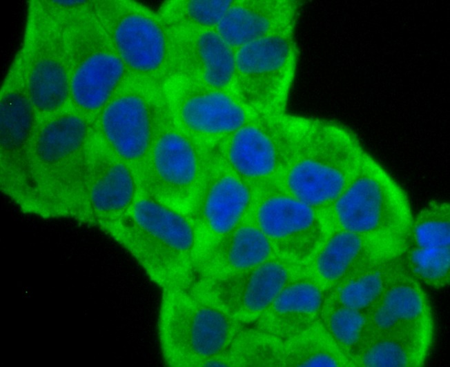 Anti-FSCN1 Antibody (7Z181)