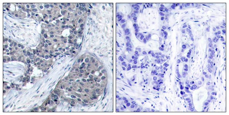 Anti-Phospho-EIF4E (Ser209) Polyclonal Antibody