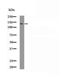 Anti-Phospho-EphA2 (Ser901) Polyclonal Antibody