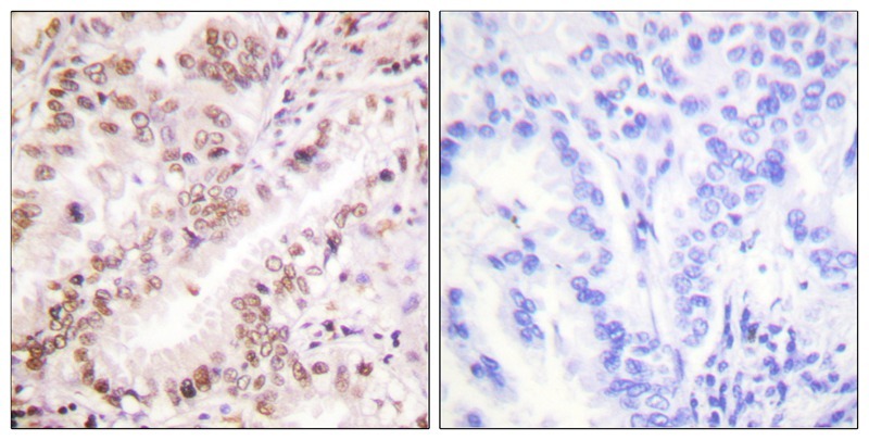 Anti-Phospho-ER alpha (Tyr537) Polyclonal Antibody