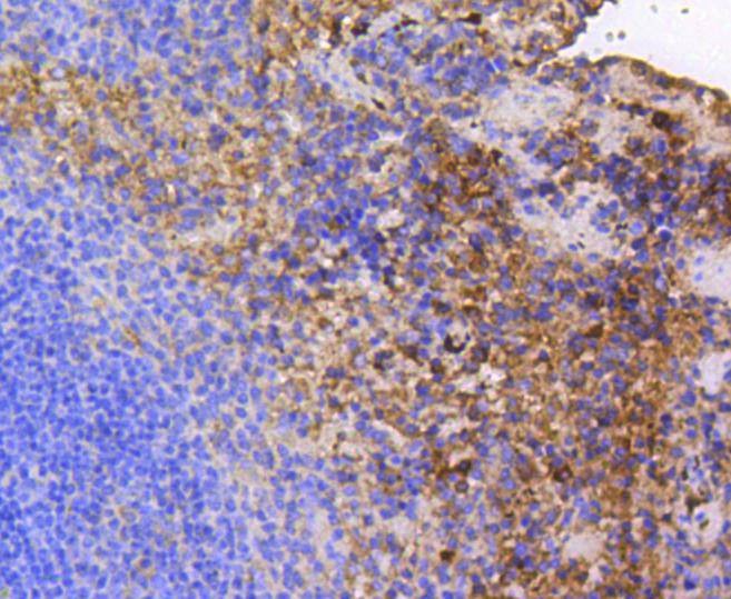 Anti-PTK2 Antibody (4L758)
