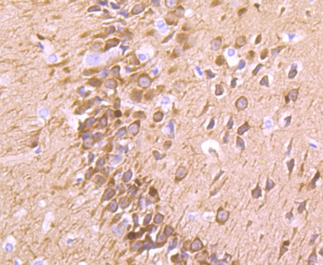 Anti-FSCN1 Antibody (7Z181)