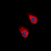 Anti-Phospho-EphA2 (Tyr588, 596) Polyclonal Antibody