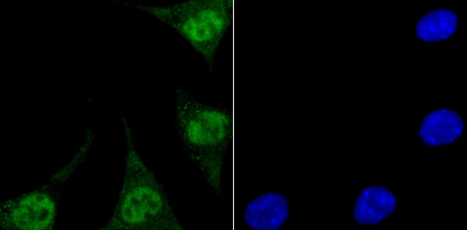 Anti-Endo G Antibody (1O411)
